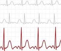 تطوير تقنية تخطيط كهربائية القلب باستخدام إشارات من الأذن واليد 
