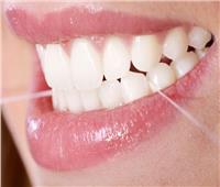 استشاري: «الخيط» أفضل وسيلة لتنظيف فراغات الأسنان 