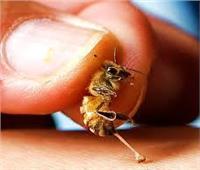 صور| علاج أمراض الروماتويد والعيون وعرق النسا.. كل ما يخص التداوي بـ«لدغ النحل»