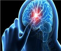 فيديو| استشاري مخ وأعصاب يكشف عن مخاطر السكتة الدماغية