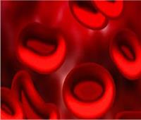  انتشار «سيولة الدم» ثلاثة أضعاف مما كان معروفًا 