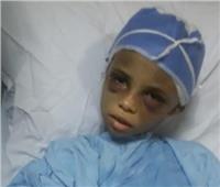 صور| وزيرة التضامن توجه برعاية «طفلة التعذيب بالشرقية»