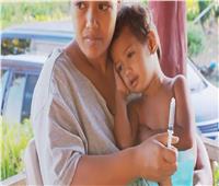 ارتفاع حصيلة الوفيات بسبب الحصبة في جزيرة «ساموا» لـ 60 شخصا