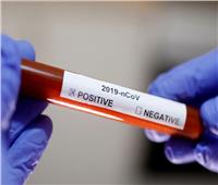 عاجل| قطر تسجل 238 حالة إصابة جديدة بفيروس كورونا