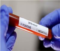مسؤول أمريكي يعلن موعد طرح أول جرعة من لقاح ضد فيروس كورونا