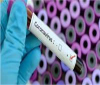 روسيا: إجراء أكثر من 3.3 مليون فحص لتشخيص حالات الإصابة بفيروس "كورونا"