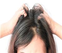 عوامل تؤدي لفشل عملية زراعة الشعر
