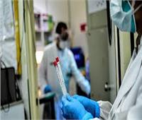 روسيا تجري 5.4 مليون فحص طبي للكشف عن فيروس "كورونا "