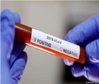 الصحة الروسية تجري أكثر من 5.8 مليون اختبار للكشف عن فيروس كورونا