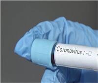 فيديو| مدير مكافحة العدوى يكشف حقيقة جديدة عن فيروس كورونا