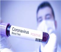 فيروس كورونا يعود للظهور في بلدٍ أوروبيٍ تعافى سابقًا من الوباء