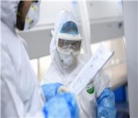 السعودية تكشف عدد حالات علاج كورونا «ببلازما الدم»