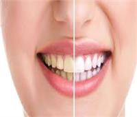 في اليوم العالمي للابتسامة.. طرق الحفاظ على أسنانك من الاصفرار