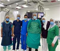 نجاح أول قسطرة مخية تحت مظلة التأمين الصحي لأول مرة في بورسعيد