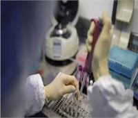 روسيا تُسجل 17 ألفا و347 إصابة جديدة بفيروس كورونا خلال 24 ساعة