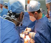 نجاح استئصال فص من الكبد لمريض تحت مظلة التأمين الصحي ببورسعيد 
