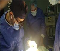 إجراء عملية جراحية ناجحة لرضيع يعاني من تضخم في القولون ببني سويف