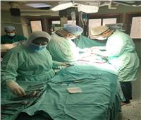 إجراء عملية قلب مفتوح لطفلة عمرها 3 سنوات بمستشفى المنصورة الدولي