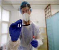 التشيك تسجل 16 ألف إصابة جديدة بفيروس «كورونا»