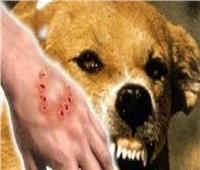 غالبًا ما يسبّب الوفاة.. إجراءات عليك اتباعها إذا تعرضت لـ«عضة الكلب»