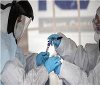 العاصمة اليابانية تسجل 986 حالة إصابة جديدة بفيروس كورونا خلال 24 ساعة