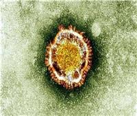 أول رد من الصين على انتشار فيروس «نيباه»
