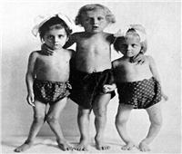 وصفة مصرية صدرت في خمسينيات القرن الماضي تقي الأطفال من «الكساح»  
