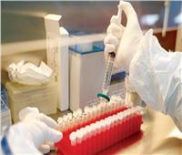 روسيا تسجل نظام اختبار للكشف عن سلالات مختلفة من فيروس «كورونا»