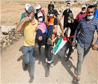 إصابة 3 فلسطينيين بالرصاص وعشرات بالاختناق خلال قمع الاحتلال مسيرة بيت دجن