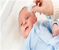 أسباب رمد العين عند حديثي الولادة.. وطرق الوقاية 