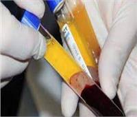 «بنك الدم الإقليمى» نقلة حضارية لتطوير منظومة الصحة بدمياط