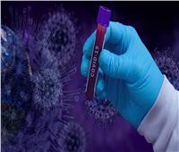 اليابان تطور تقنية تكشف عن فيروس كورونا خلال 5 دقائق