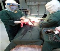 ولادة قيصرية لمصابة كورونا داخل مستشفى الخارجة في الوادي الجديد 