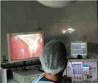 إجراء 5 عمليات جراحية لاستئصال أورام بمستشفى السعديين بالشرقية 