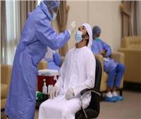الصحة الإماراتية: تسجيل 1508 إصابات جديدة بفيروس كورونا