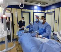 إجراء قسطرة قلبية لـ 438 مريضا بمستشفى الزقازيق العام 
