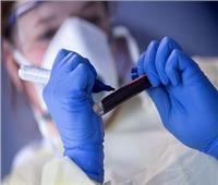 تايلاند تسجل 3 آلاف و667 إصابة جديدة بفيروس كورونا و32 وفاة