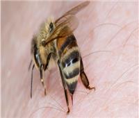 نصائح صحية| خطوات بسيطة  لعلاج لدغات النحل طبيعيا