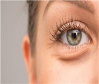 جراح روسي يوضح طرق طبيعية لعلاج انتفاخ العين وأسبابه