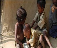 استشاري تغذية: صندوق «يونيتلايف» يهدف للقضاء على سوء التغذية حول العالم 