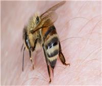 حيل منزلية للتخلص من لسعات النحل على الأطفال 