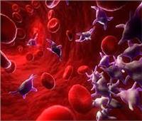حسام موافي يوضح أسباب وأعراض نقص الصفائح الدموية | فيديو