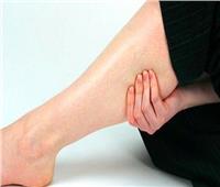 جلطة الساق.. الأعراض وطرق الوقاية