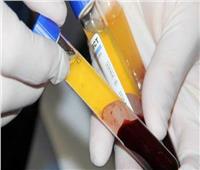 مدير عام خدمات نقل الدم يكشف فوائد التبرع بالبلازما 