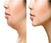 5 تمرينات تساعد على فقدان دهون الوجه