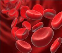 منها أورام الكلى.. 8 أسباب لارتفاع كرات الدم الحمراء عند الأطفال