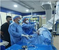 إجراء ٦٣٣ قسطرة قلبية مجانًا بمستشفى الزقازيق العام 
