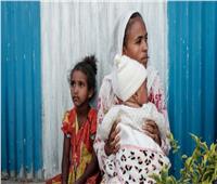 وكالات أممية تُحذر من معاناة أطفال أفغانستان دون سن الخامسة من سوء التغذية 