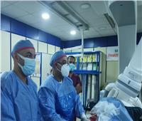 إجراء قسطرة قلبية لـ660 مريضًا بمستشفي الزقازيق العام 