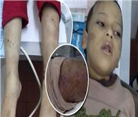 «الداخلية» عن تعذيب طفل على يد زوجة والده: «قديم من 2018» 